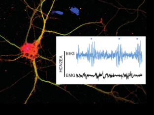 seizures_knock-in Mouse HCN2 channel